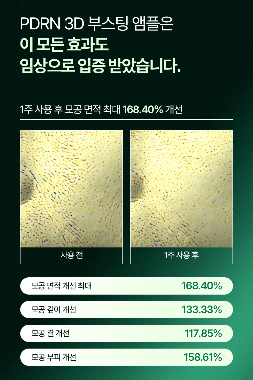 [티벳동생 공동개발] 오아조 피디알엔 쓰리디 부스팅 앰플 30ml 상세페이지 4
